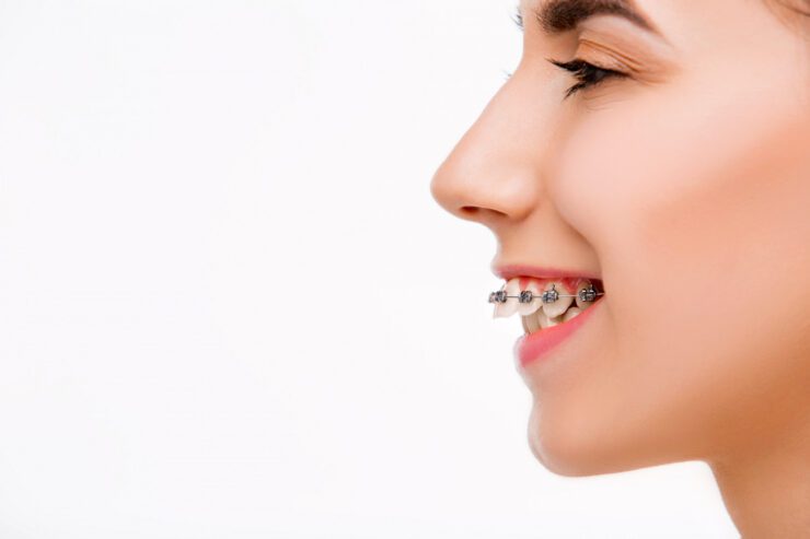 Fiksna Proteza za Zube